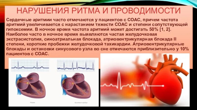 Нарушение ритма сердца форум. Нарушение ритма и проводимости. нарушение сердечного ритма и проводимости. сердечные нарушения. аритмия сердца.