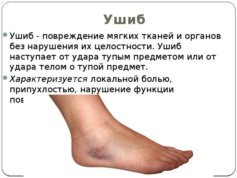 После ушиба образуется уплотнения