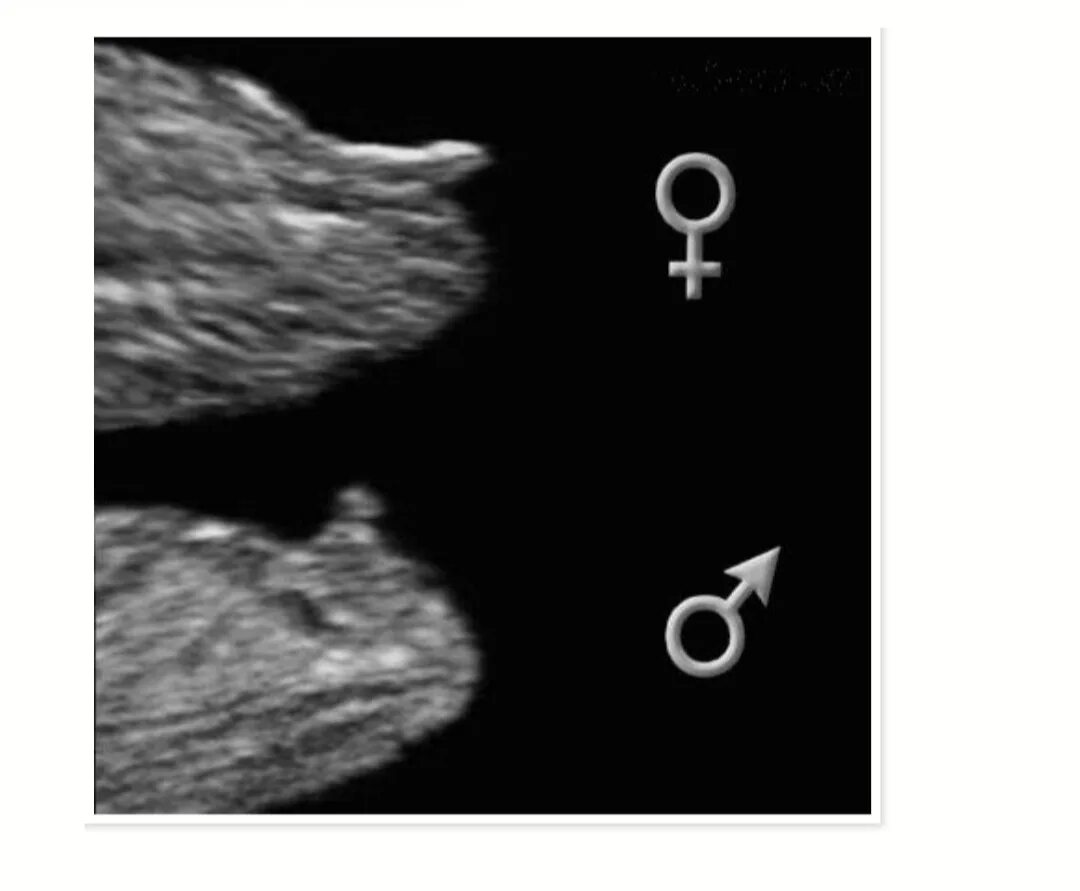 Как отличить на узи. Как определить пол ребёнка на 12 неделе ребенка по УЗИ. Как по фото УЗИ определить пол ребенка в 12 недель. Как на УЗИ понять пол ребенка 12 недель беременности. Определение пола плода по УЗИ на 12 неделе.