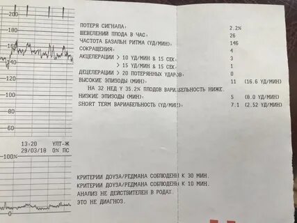 36 неделя беременности ктг нормы