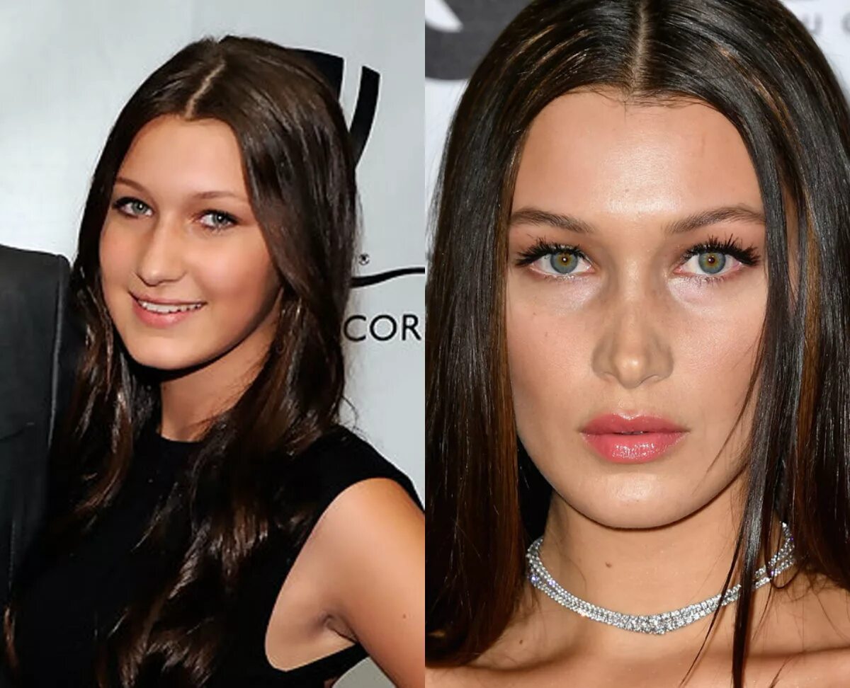 Bella Hadid до пластики. Сестра беллы хадид