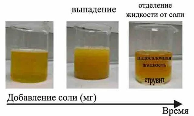 Можно мочу ставить в холодильник. Соли в моче. Осадок в моче. Моча соленая. Примеси в моче.