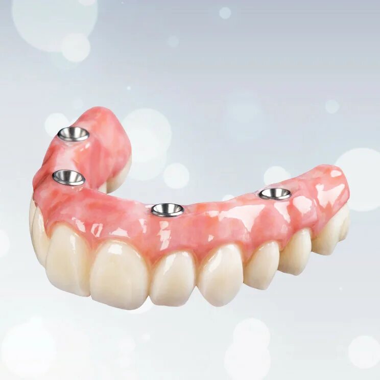 Зубные протезы нового поколения цена. Съемный протез (6-14 зубов) термо Джет. Вставной зубной протез. Протез на верхнюю челюсть.