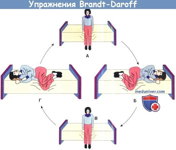 Гимнастика Брандта Дароффа. Упражнения Брандта-Дароффа при головокружении. Гимнастика вестибулярного аппарата Брандта Дароффа. Упражнения при доброкачественном головокружение.