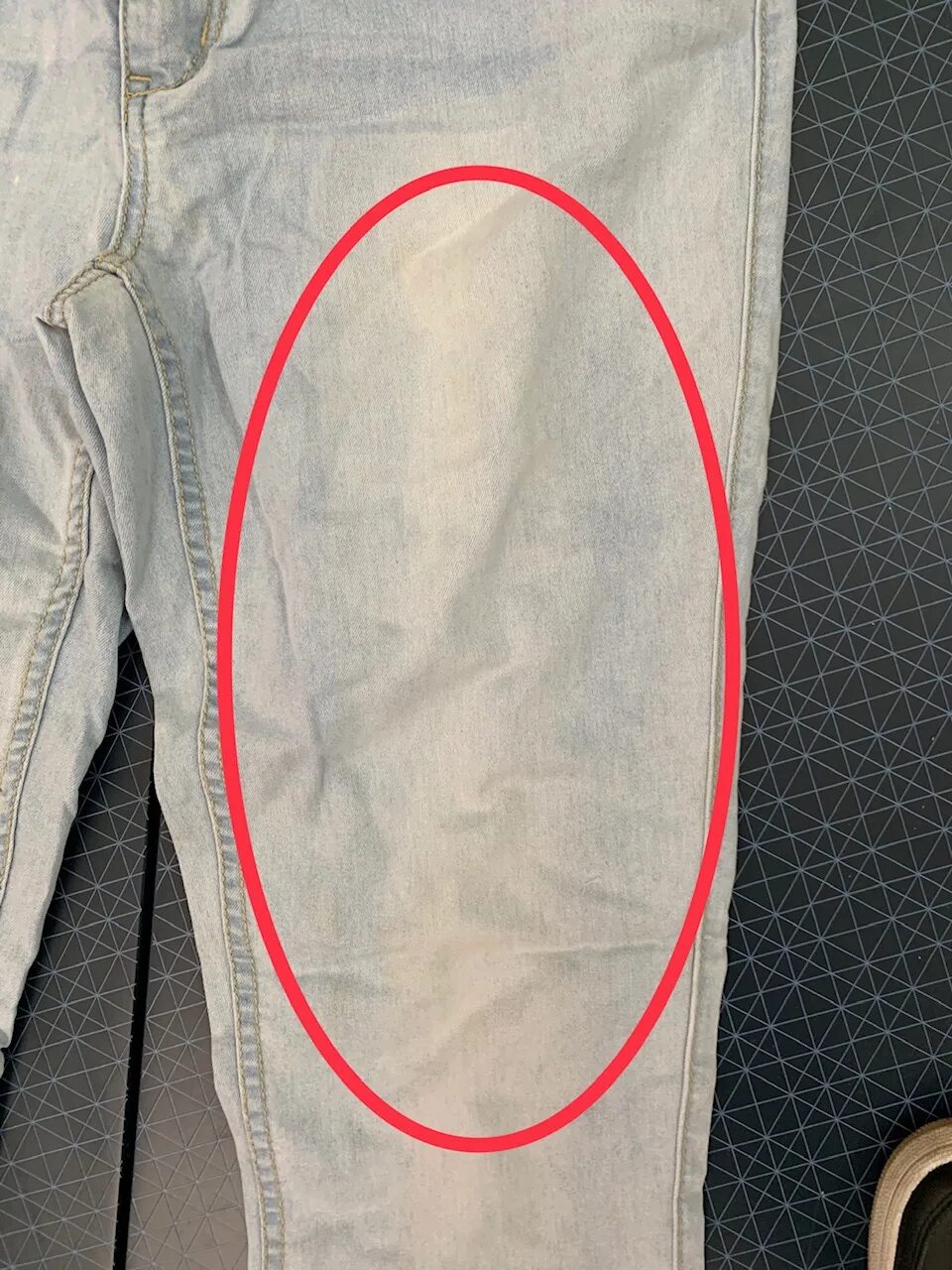 Черные брюки выцвели. Белые пятна брюках. Белые пятна брюках. Химчистка брюк. Плесень на вещах.