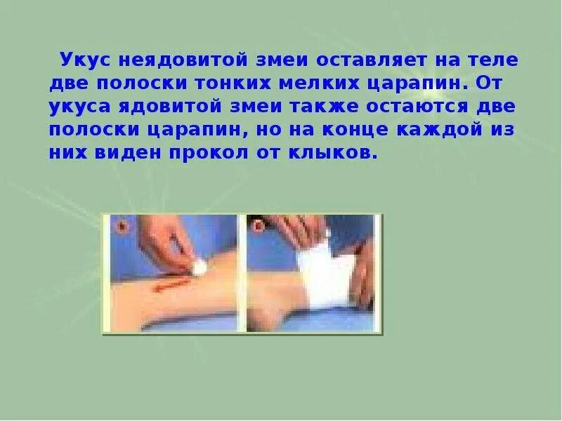 Девушка кусает мужчину. Девушка кусает мужчину. Оказание помощи при укусе пчелы. Фразы из книг про любовь. Щас покусаю.
