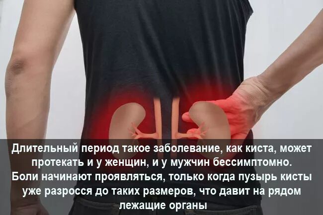 Можно ли простудить почки и какие симптомы. Болят почки симптомы. боли при болезни почек. признаки что болят почки.