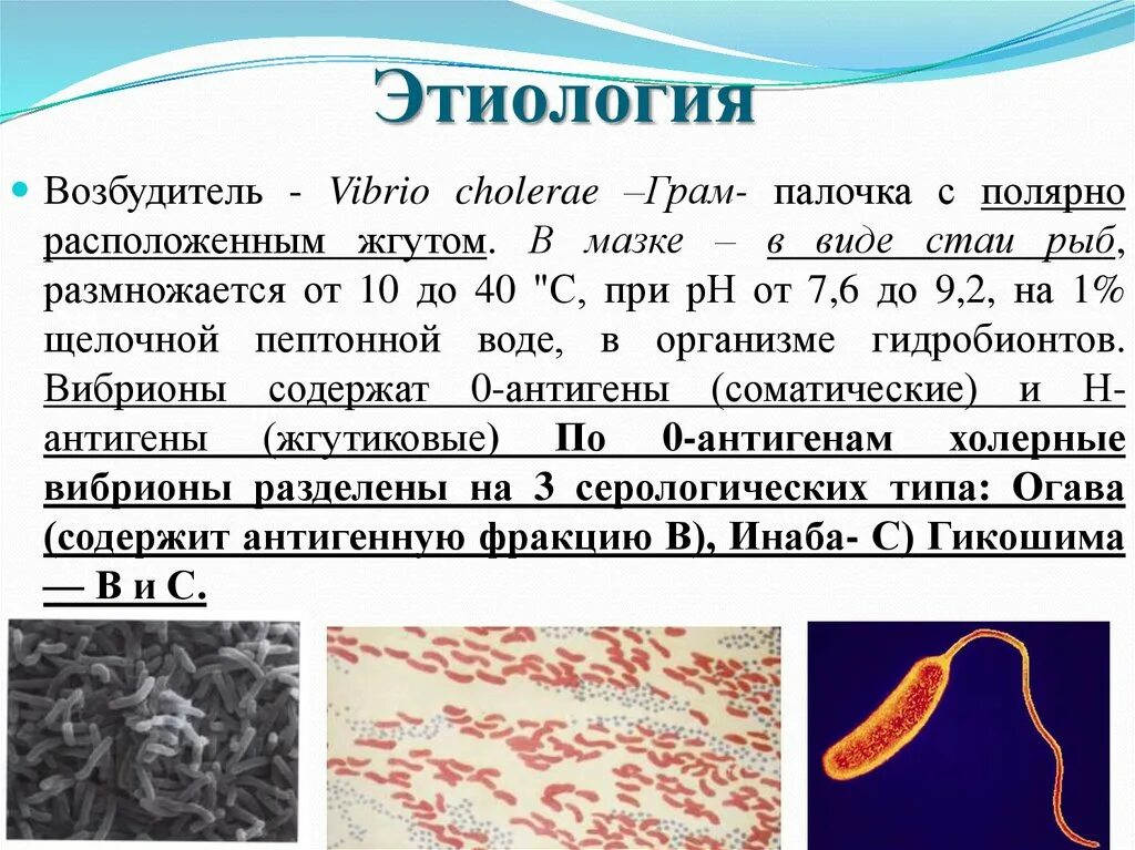 Организм трутовик окаймленный холерный вибрион. Vibrio cholerae морфология. Вибрио холера морфология. Холерный вибрион микробиология.