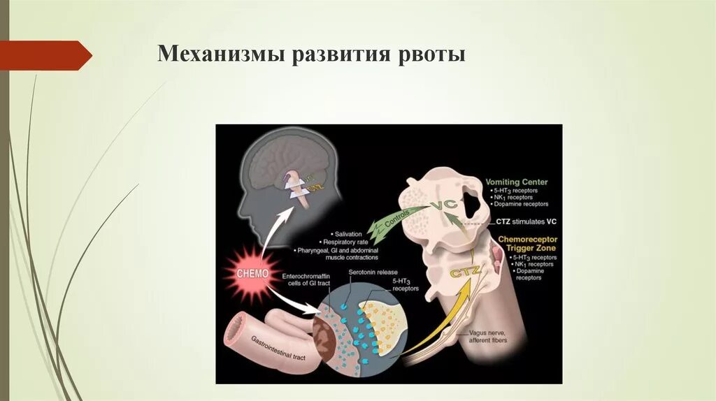 Механизм образования рвоты. Механизм развития тошноты. Патогенез тошноты и рвоты. Рвота механизм возникновения.