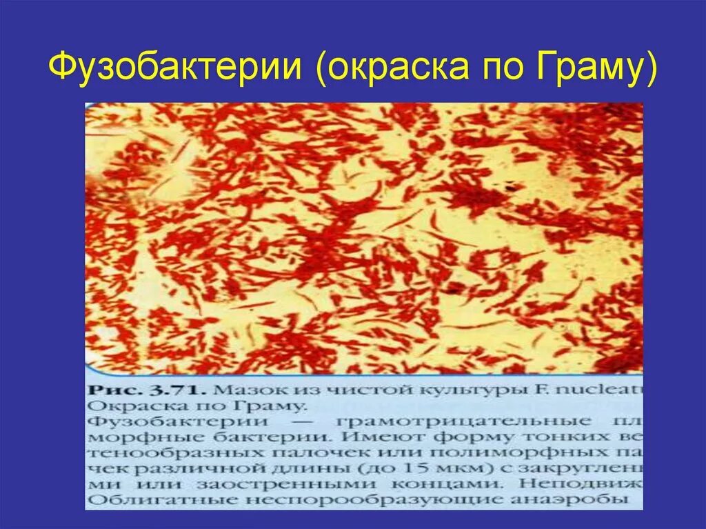 Fusobacterium spp. Фузобактерии окраска по граму. fusobacterium nucleatum морфология. fusobacterium necrophorum морфология. фузобактерии питательные среды.