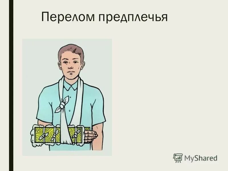 первая помощь при переломе предплечья кратко