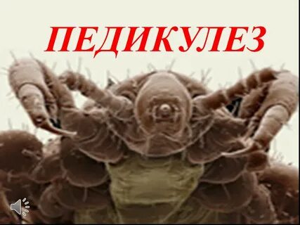 Смешные картинки вши