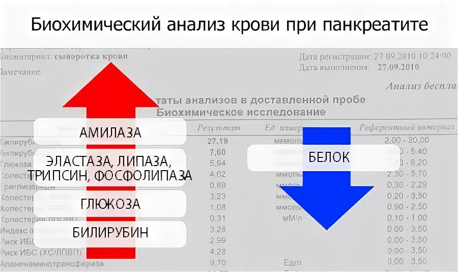 Как проверить поджелудочную железу какие анализы сдать. Биохимия крови при панкреатите показатели. Биохимические показатели острого панкреатита. Острый панкреатит биохимия показатели. Панкреатит общий анализ крови показатели.