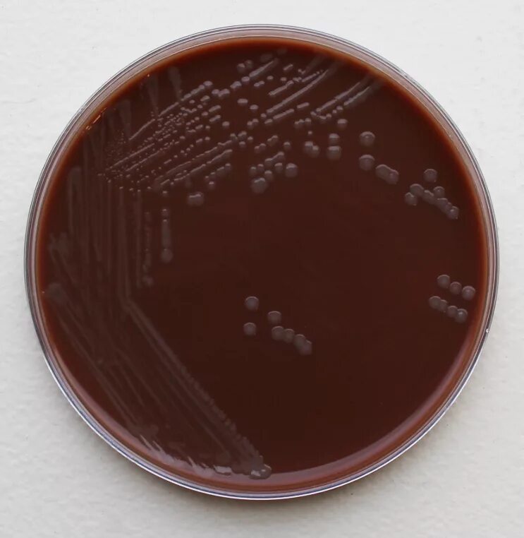 Ба агар. Бактерии Haemophilus influenzae. Haemophilus influenzae культуральный. Бактерия гемофильная палочка. Гемофильная палочка на кровяном агаре.