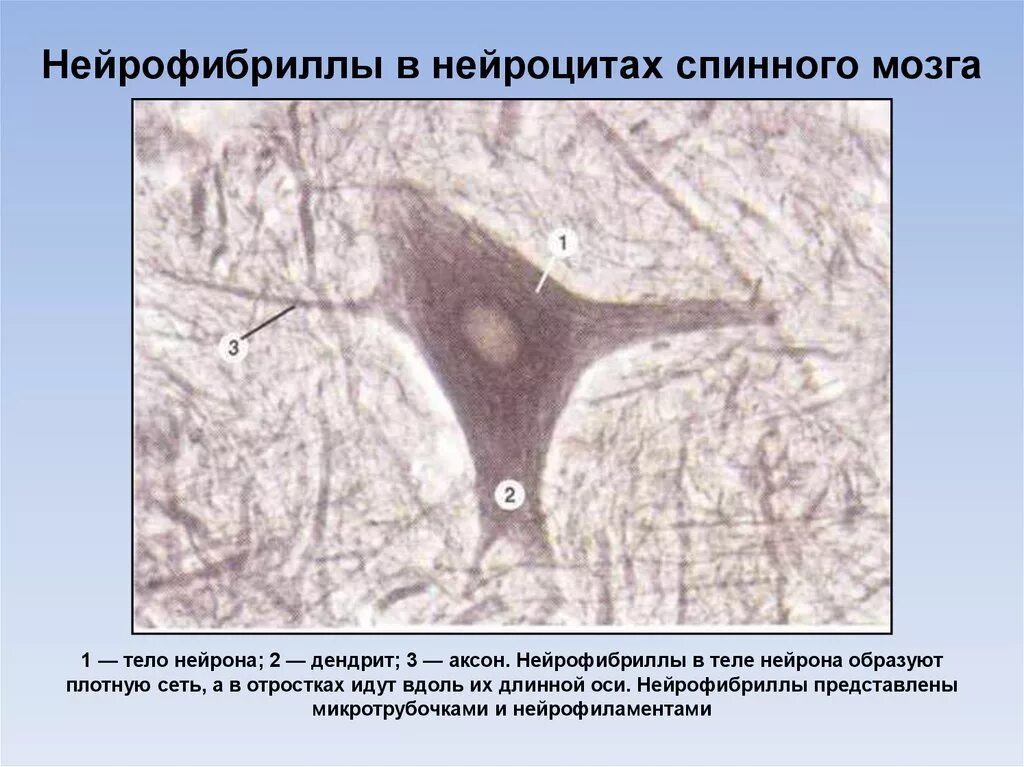 22. Нейрофибриллы в нейронах спинного мозга. Нейрофибриллы в нейронах спинного мозга гистология. Строение нейрофибриллы гистология. Нейрофибриллы в нервных клетках спинного мозга препарат.