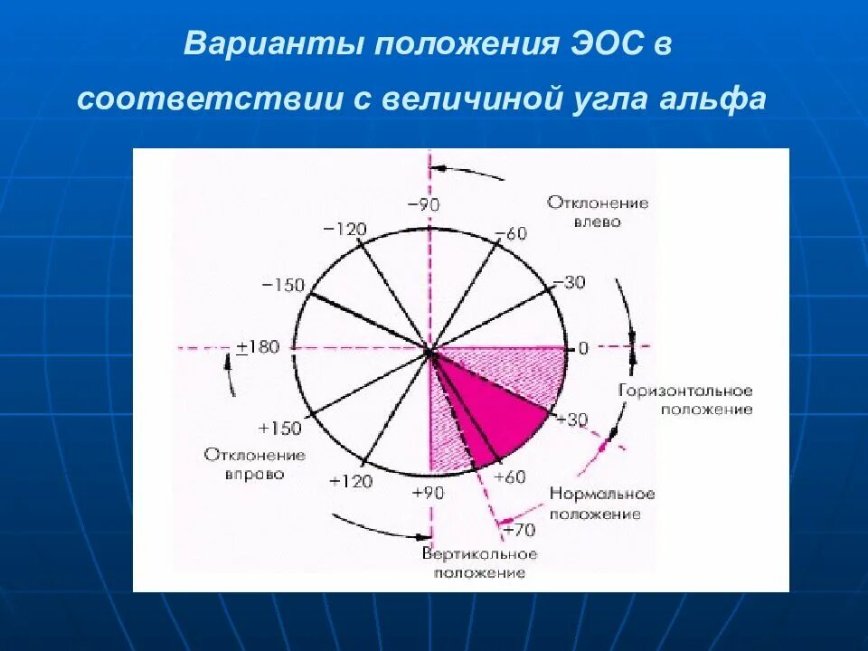 Эос гуппрос. Варианты положения эос. электрическая ось. эос коллекторы. угол альфа.