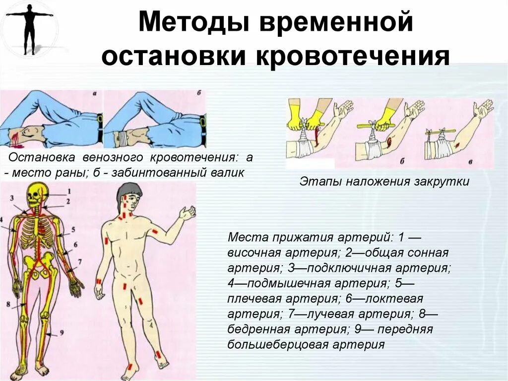 Методы временной остановки крови. Алгоритм временной остановки кровотечения. Способы и техника временной остановки наружного кровотечения. Первый этап временной остановки артериального кровотечения.