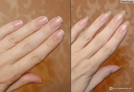 Можно ли ногти без геля
