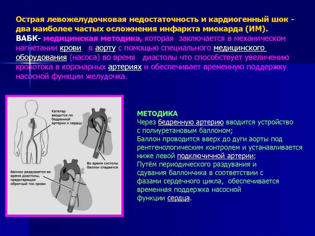 Левожелудочковая недостаточность осложнения. Острая левожелудочковая недостаточность осложнения. Кардиогенный ШОК левожелудочковая недостаточность. Реанимация острой сердечной недостаточности. Осложнения острой сердечной недостаточности