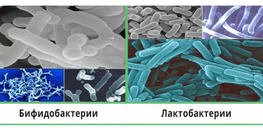 Бифидобактерии где. Лактобактерии и бифидобактерии. Симбионты:лактобактерии,бифидобактерии,........ Бактерии Bifidobacterium longum. Бифидобактерии бифидум + лактобактерии.