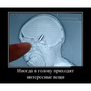 Иногда головы