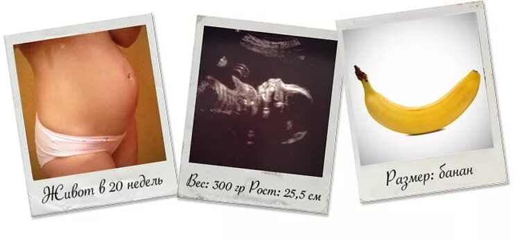 Вес плода на 19 неделе беременности норма. Размер эмбриона по неделям беременности таблица по узи. 75. Снимок узи на 19 неделе беременности. Ребёнок в 19 недель беременности размеры плода.
