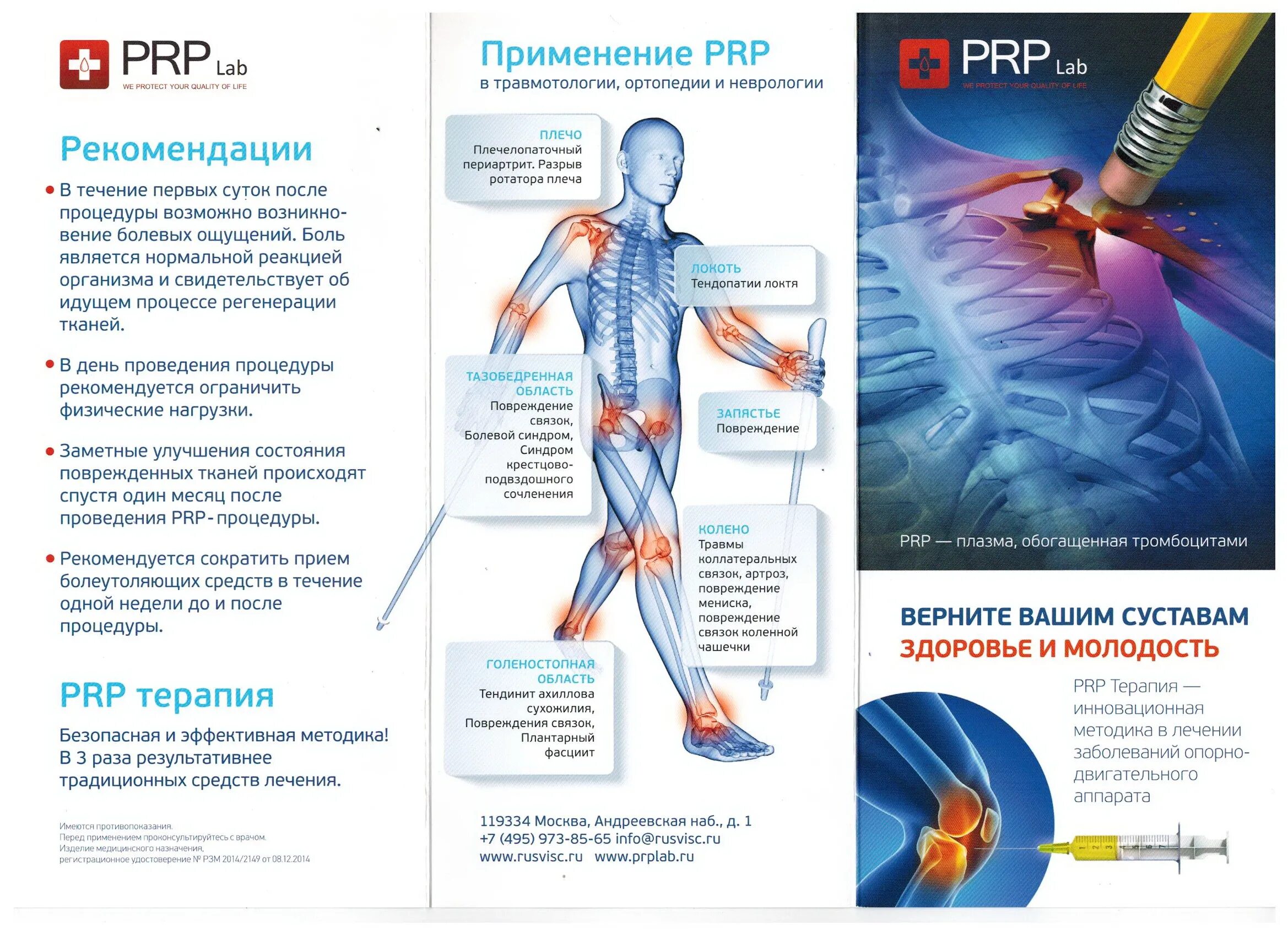 Плазмолифтинг PRP терапия коленного сустава. PRP терапия плазма в коленный сустав. Плазмотерапия суставов (PRP-терапия, плазмолифтинг). Плазмотерапия плазма коленного сустава. Плазмолифтинг колена отзывы