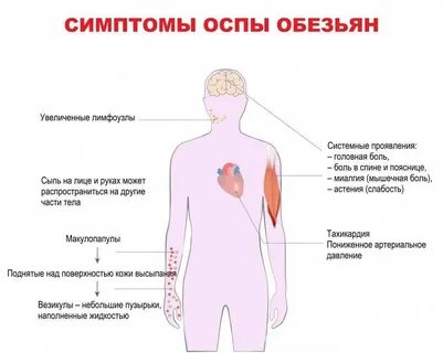Оспа обезьян у человека как передается симптомы