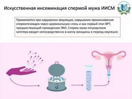 Можно ли делать инсеминацию