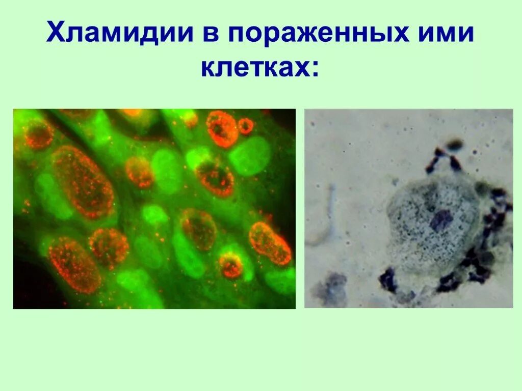 Хламидия 5. Хламидии в пораженных ими клетках. Хламидии облигатные внутриклеточные паразиты. Хламидии клетки пораженные. Поражение клетки хламидиоз.