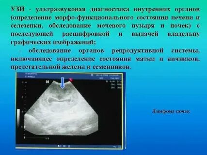 Узи тихонович