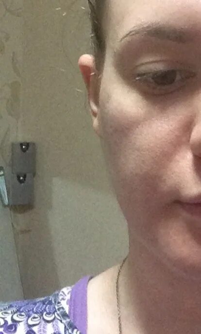 Щеки и скулы. Андрей скулов муж ауг. Осунувшееся лицо. Почему щека впала. Впалые щеки.