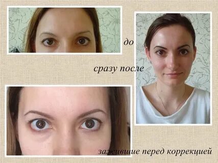 Перед коррекцией