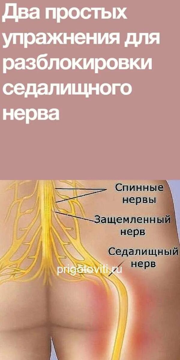 Сидальческий нерв лечение у мужчин. Седалищный нерв. Разблокирование седалищного нерва. Два простых упражнения для разблокировки седалищного нерва. Защемило седалищный нерв.