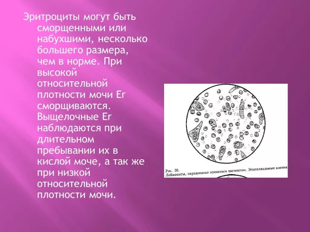 Сколько эритроцитов в моче