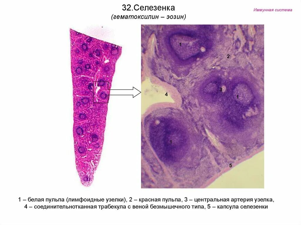 Селезенка окраска гематоксилин-эозином. Селезенка с гемопоэзом гистология. Белая пульпа селезенки гистология. Селезенка микропрепарат гистология. В селезенке образуются клетки