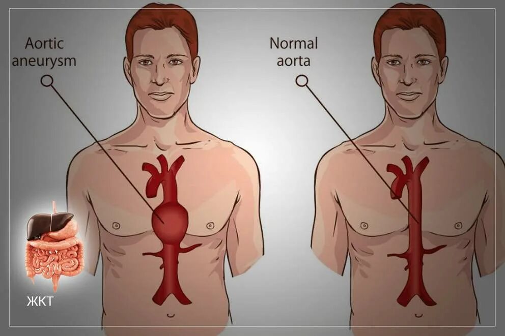 Пульсирующий живот у мужчин. Пульсирует живот. Пульсация сердца в животе. Почему пульсация в животе.