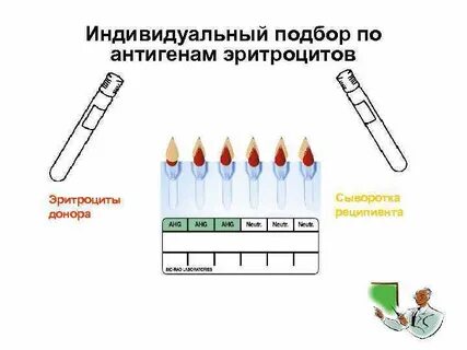 Индивидуальный подбор