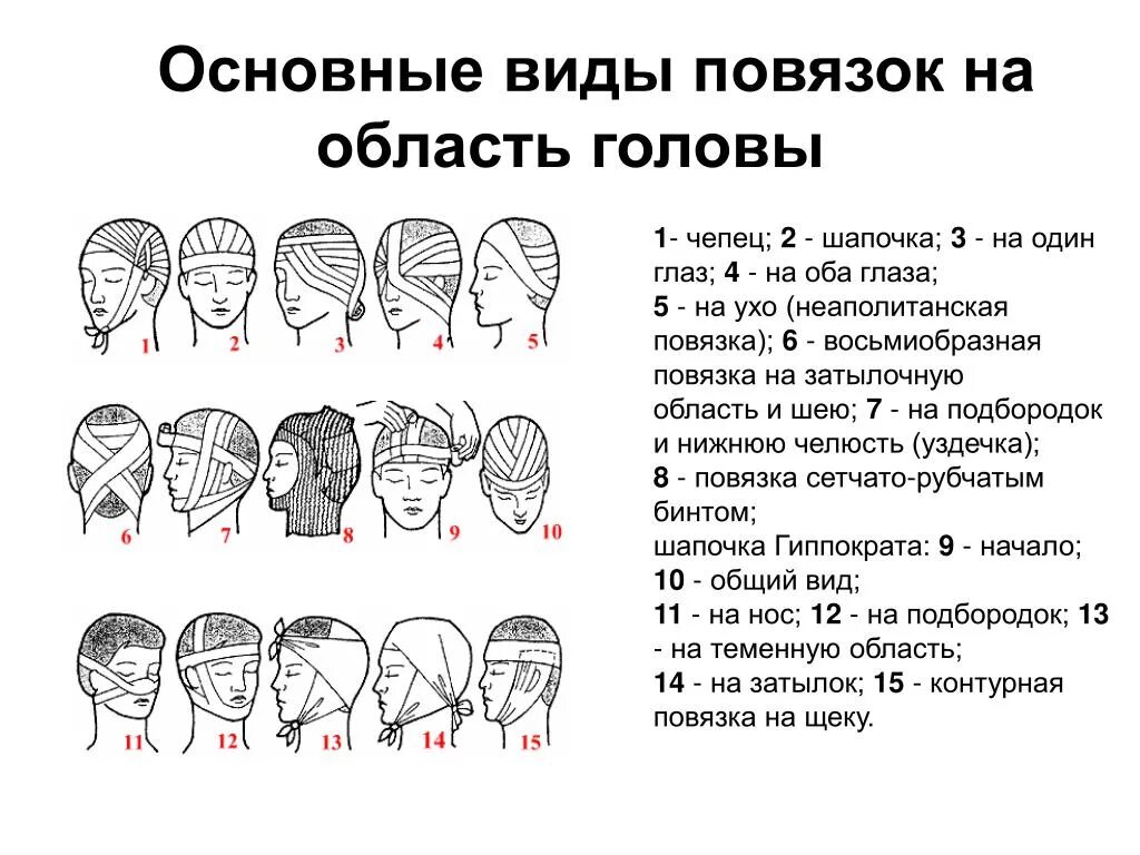 Повреждение затылка какая повязка. Виды повязок при ранении головы. Повязки при повреждении головы. Повязка на голову при ранении. Вид повязки при повреждении лба.