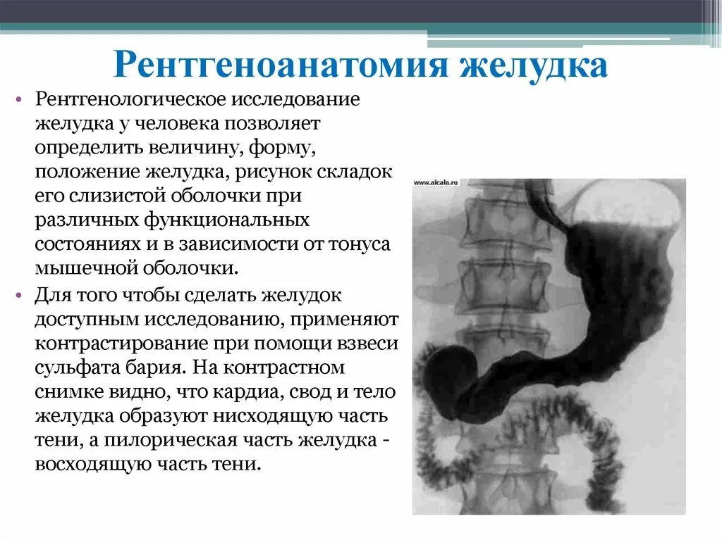 Рентгеноскопия желудка с контрастом. Рентген исследование жкт. Рентгенологическое обследование желудка. Методы исследования жкт. Рентгенологическое обследование желудка.