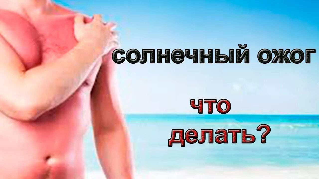 Как помочь коже при солнечном ожоге. Как помочь коже при солнечном ожоге