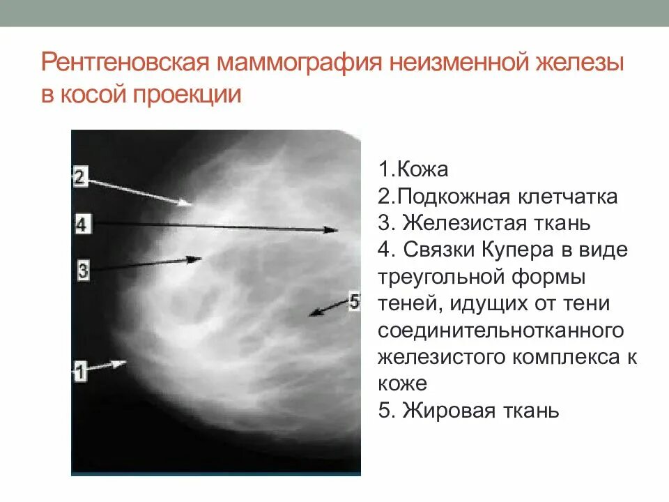 Маммография в косой проекции. Лучевые методы исследования молочных желез. Квадранты в молочной железе. Доброкачественная молочной железы. Маммография периодичность