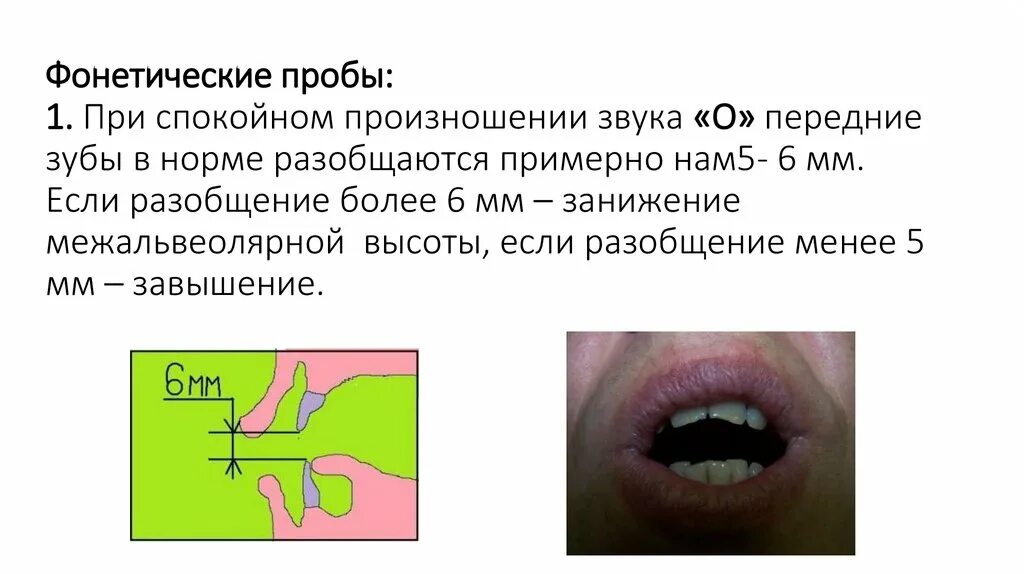 Фонетические пробы в стоматологии. Фонетические пробы в ортопедической стоматологии. Фонетическая адаптация к съемным протезам. Фонетическая адаптация к протезам при отсутствии зубов.