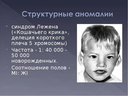 Синдром делеции