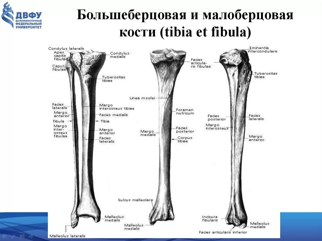 Tuberositas tibiae Med-koM