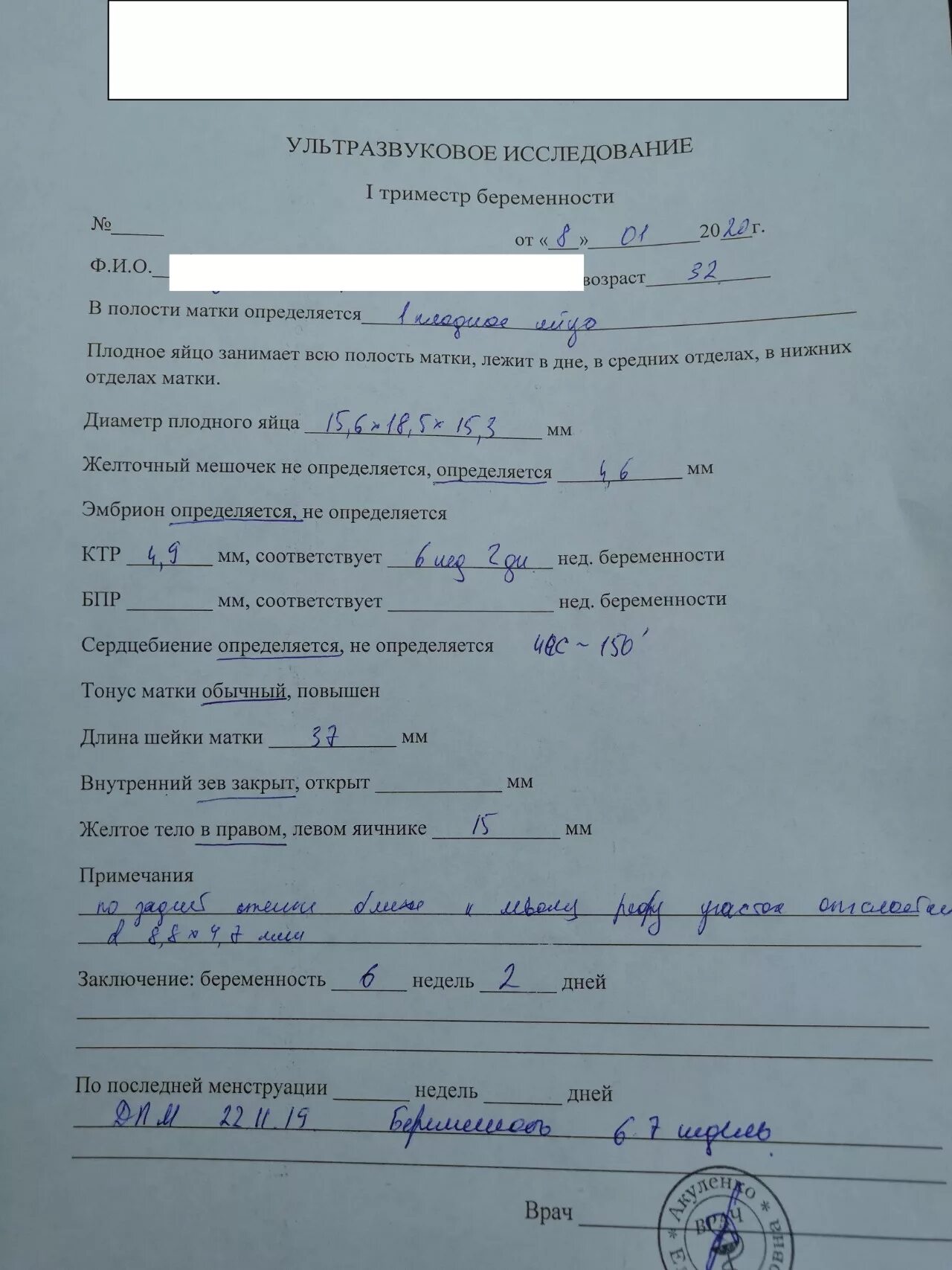 Роддом 1 скрининг. Узи 1 триместр беременности. сроки проведения узи 1 скрининг. хорошее узи в 1 триместре. скрининг узи 1 триместра параметры.