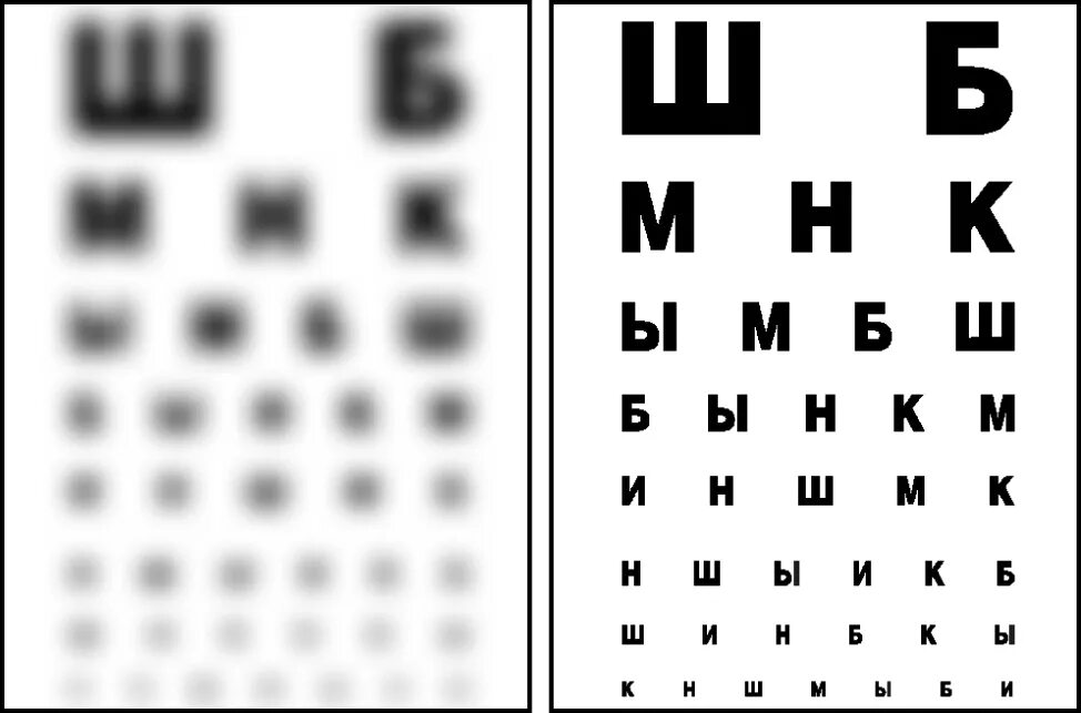 Почему зрение размытое