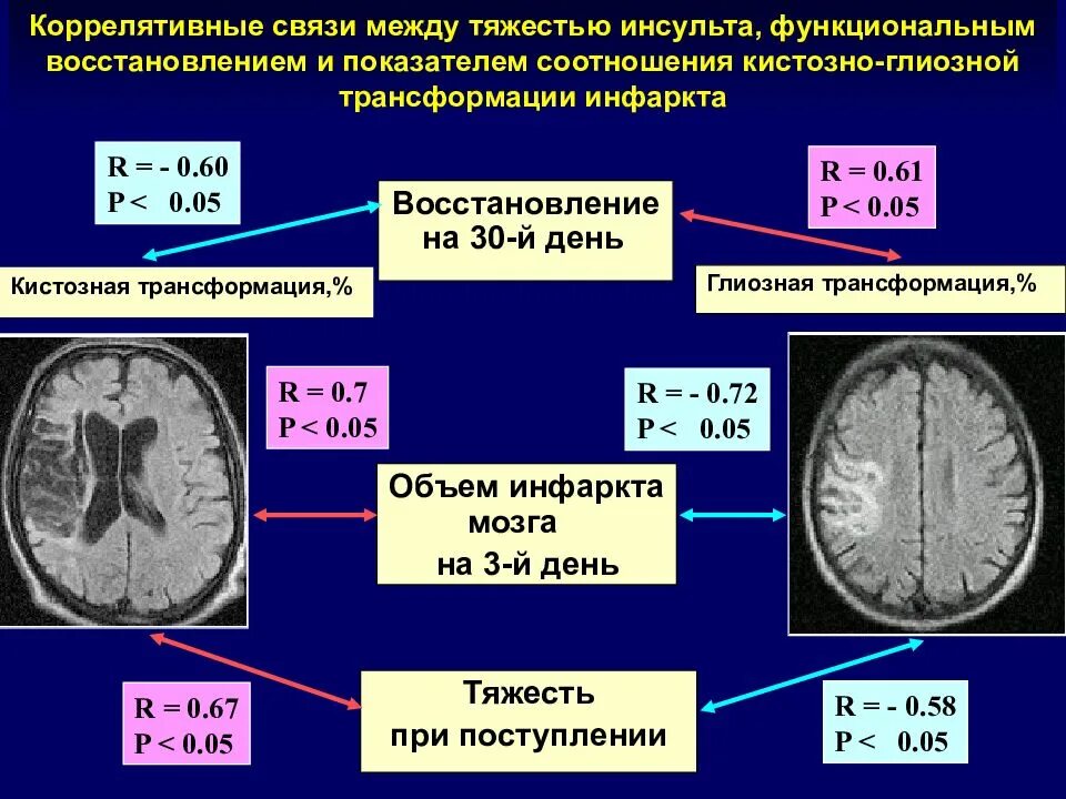 Кистозно глиозные изменения головного мозга что это. Кистозно глиозная трансформация вещества головного мозга. кистозно-глиозная трансформация на кт. кистозно-глиозная трансформация головного мозга что это такое.