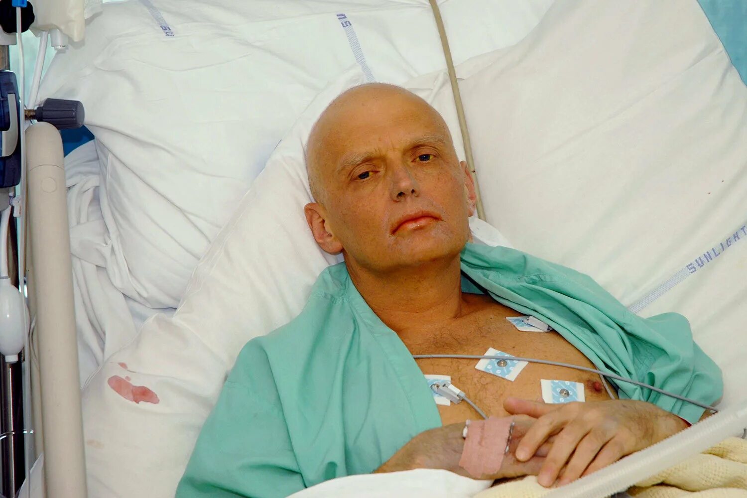 Страдающий от рака. Литвиненко отравили полонием.