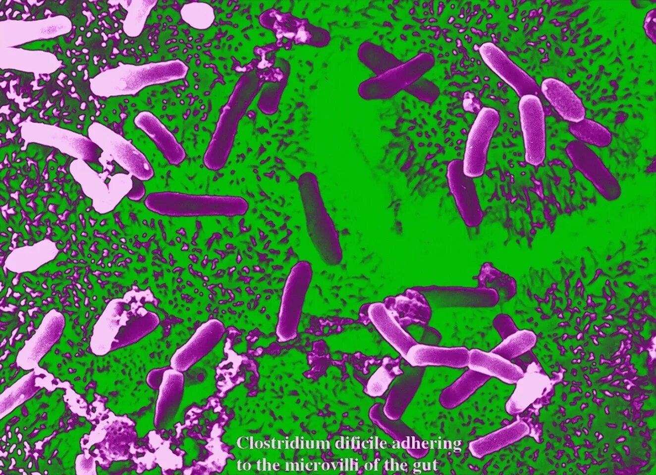 Клостридиум ботулинум микробиология. Clostridium difficile микробиология. Клостридии столбняка микробиология.